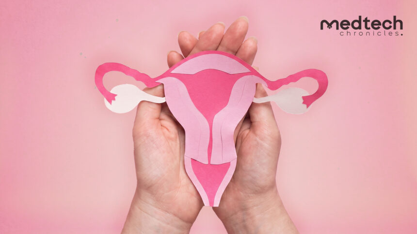 NIH Study AIML Detects PCOS