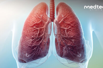 Expedition Therapeutics $115 Million Funding